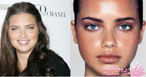 جراحی بینی - جراحی زیبایی